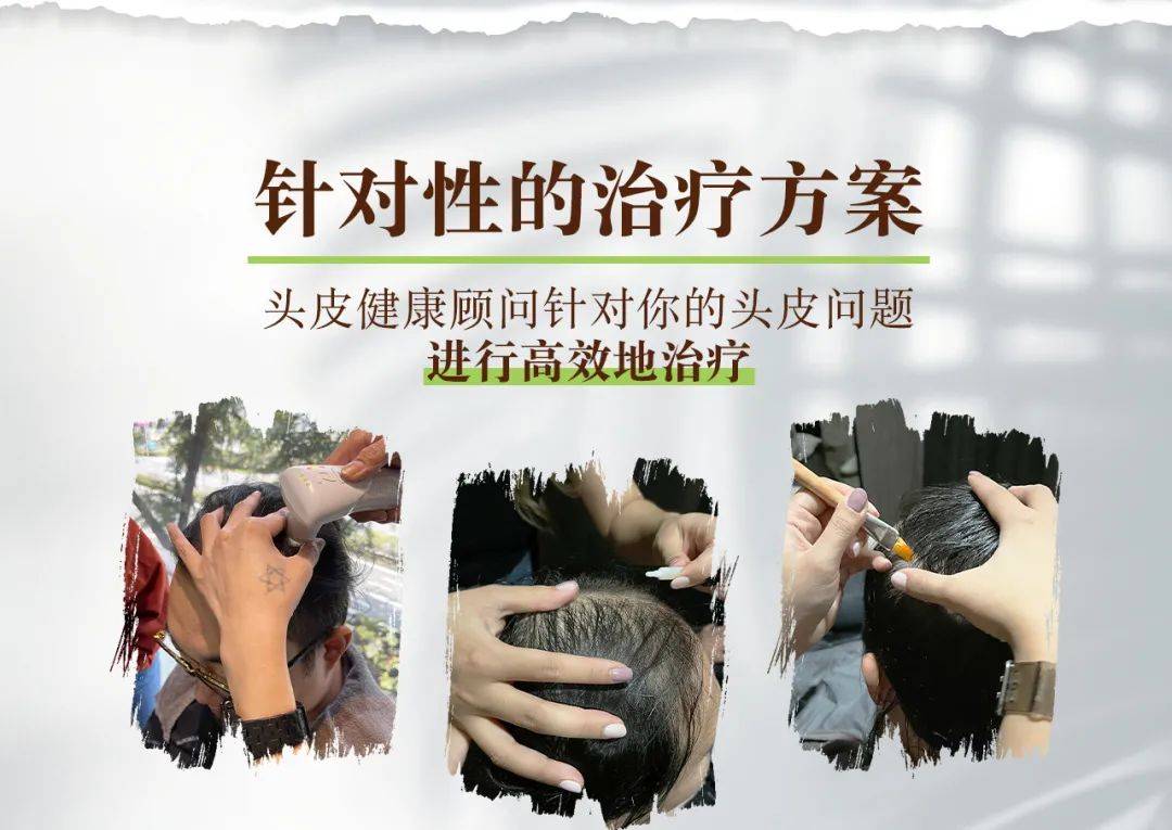 獅城這些“禿”如其來的煩惱,讓它幫你解決