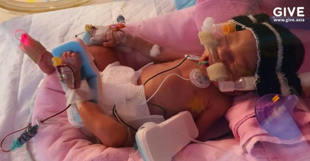 因誕下早産兒,這對馬來西亞夫婦在新加坡傾家蕩産