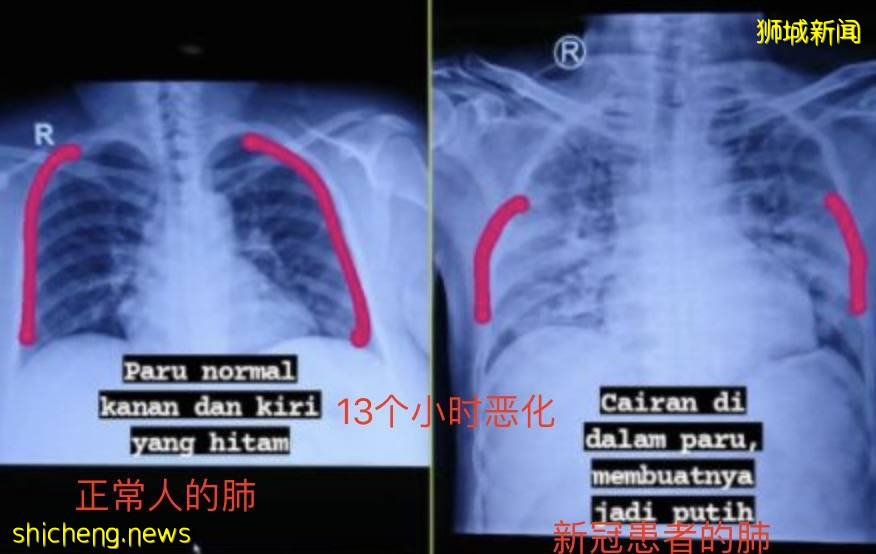 印尼淪陷!日增近4萬例、上千人死亡!警察扮鬼、民衆搶牛奶,新加坡送救援物資