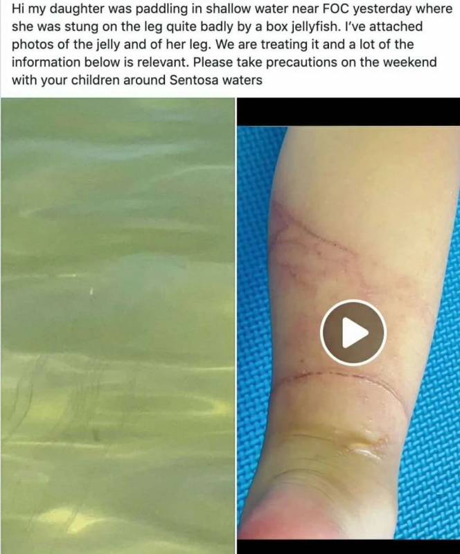 全球最毒水母惊现新加坡!西乐索海滩已禁止游泳