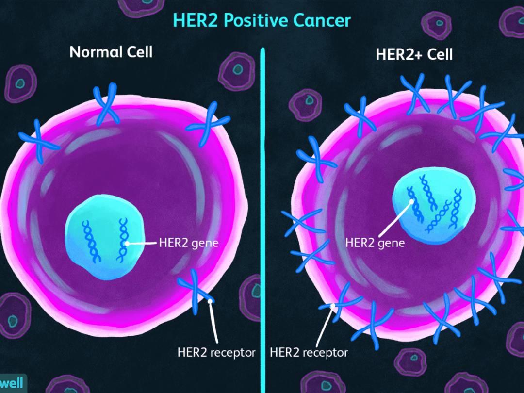 新加坡这个医院有上百名癌症患者被误诊,有人已接受17轮治疗