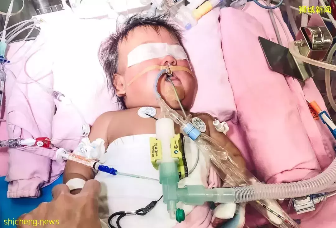 她，懷孕25周就生下孩子！寶寶出生後，在醫院躺了一年多