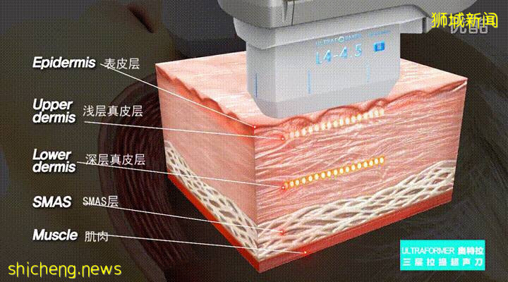 新加坡成亚洲富豪名媛聚集地!打飞的来这竟只是为了变美
