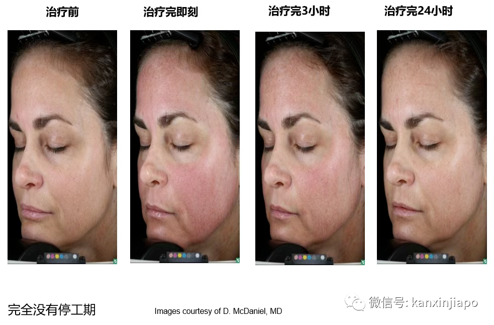 叮咚!@小仙女,己悦医美正在派送你的圣诞礼物...