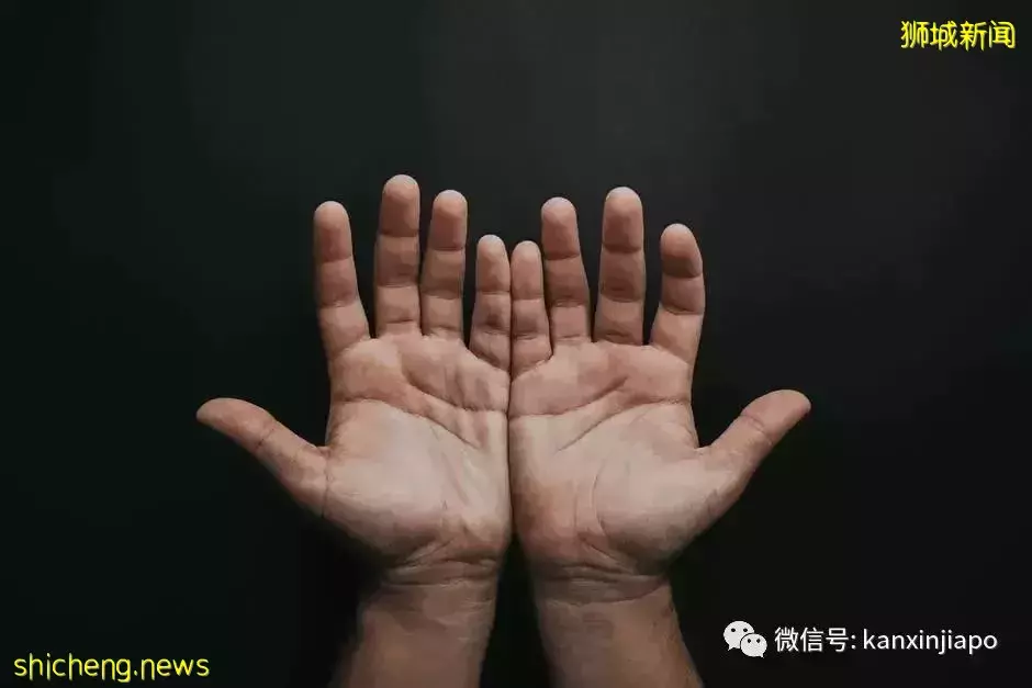 Nature子刊:看手指长度可预测患新冠严重程度