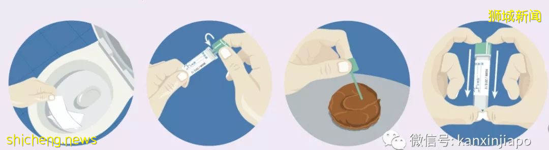 害死黑豹的大腸癌,居然是新加坡男性的頭號癌症