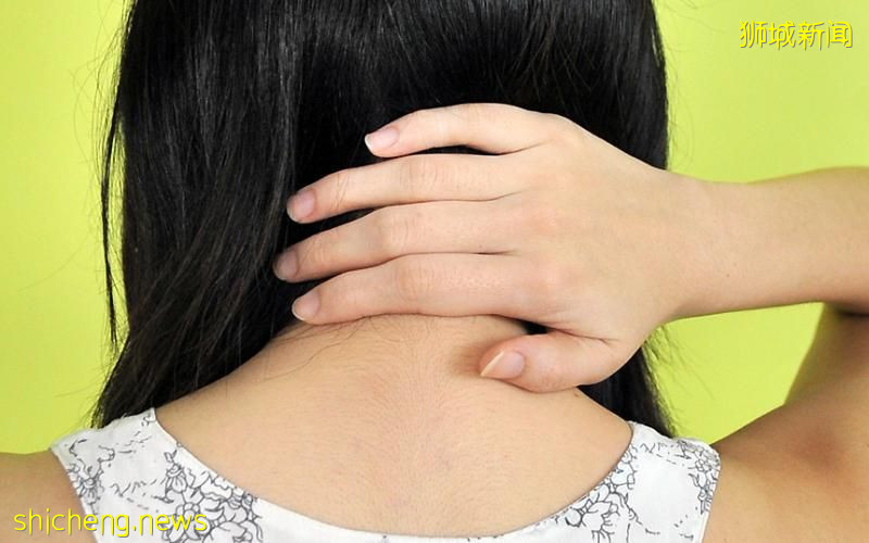 車禍後頭頸痛手指麻痹 女司機獲賠逾3萬元