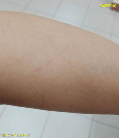 巴士玻璃窗突爆裂 女幼教手臂被刮伤