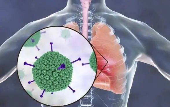 獅城時訊 新加坡客工出現冠病後遺症