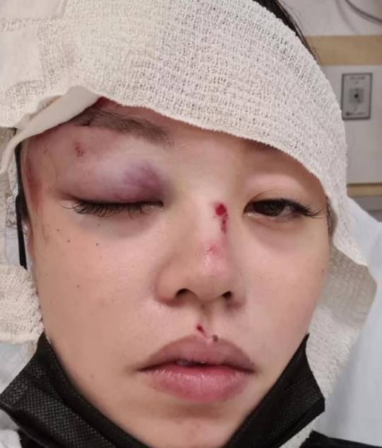 骑手酿祸端后逃逸,女子上网寻目击者