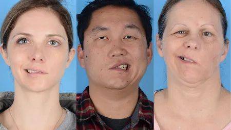 新加坡2800人有疫苗副作用!95人嚴重,荨麻疹、紅腫、呼吸困難!世衛:科興疫苗有效