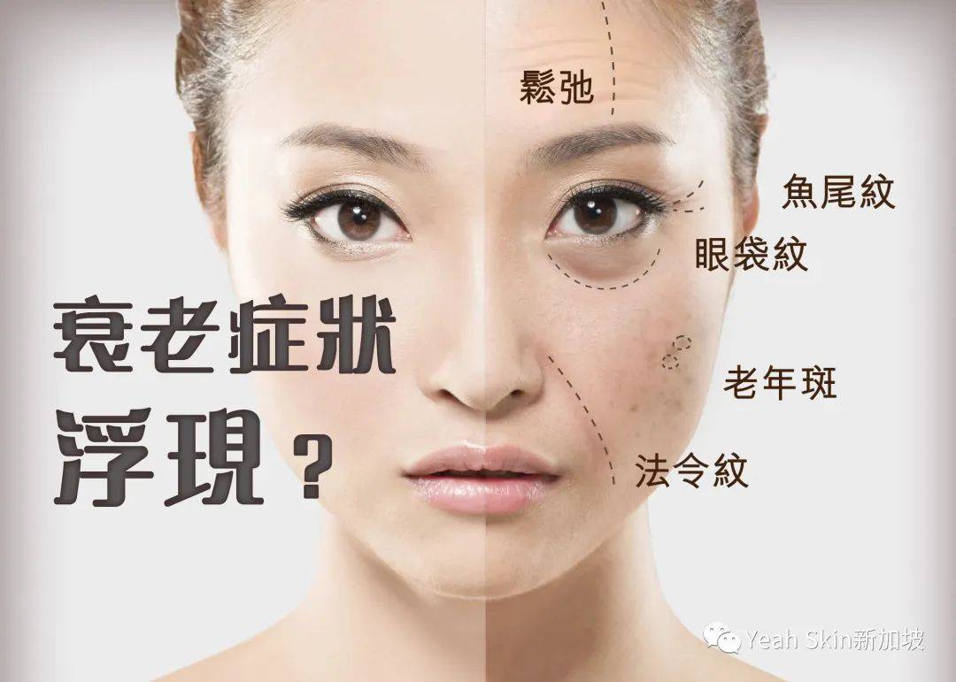 三重福利！贵妇级院线抗衰护理——法国FILLMED来新加坡啦