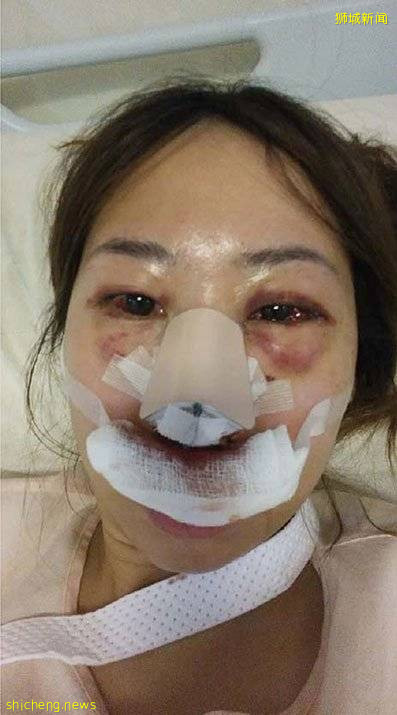 拒绝男友求欢被暴打重伤 女郎分享经历：向暴力说“不”