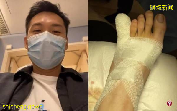 陈哲艺踢到床角 脚趾受伤 入院缝针