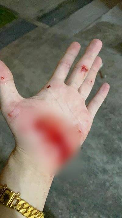 打抢新招?佯装验货抢金 青年逃终被捕