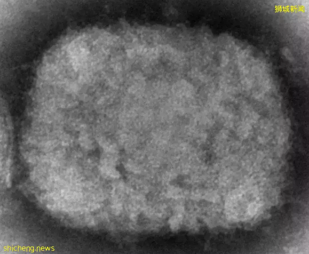 突發!新加坡組屋現不明肺結核感染群,2人死亡!多國曝“新冠+天花”病例,人畜共通