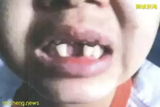 中國籍護士當著兒子面，狂扇女傭10個耳光：會打到你非常害怕爲止