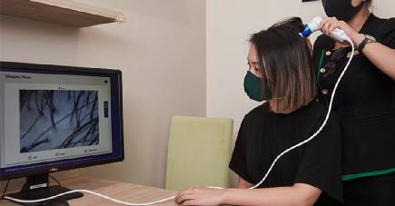 求助!来新加坡后,脱发问题严重怎么办