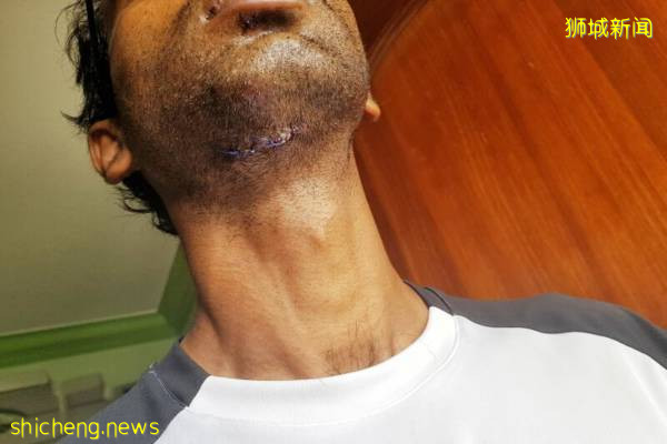 发酒疯袭击2哥哥1亲戚 送餐员和大哥被捕