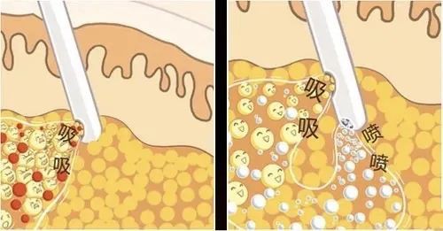 冻龄女明星偷偷都在做的那些热门「医美项目」!!你不想试试吗?