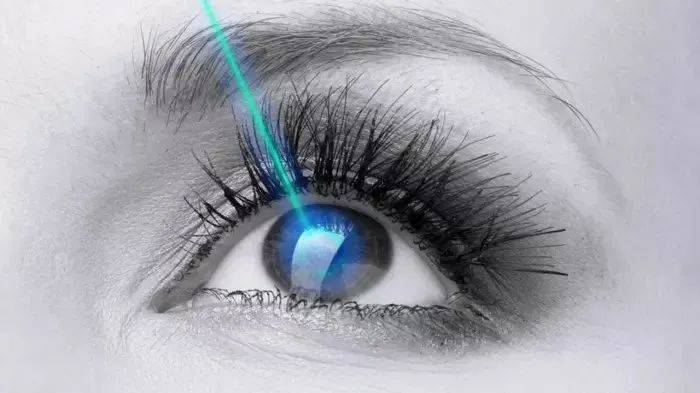 我在新加坡做了激光近視手術