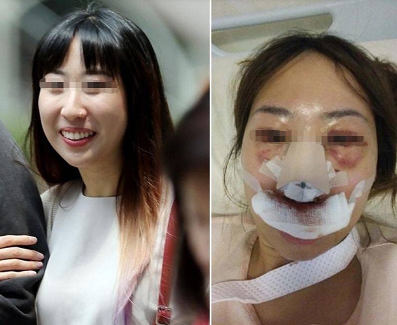 求欢不成,暴打女友!新加坡这个惯性家暴男竟是医生