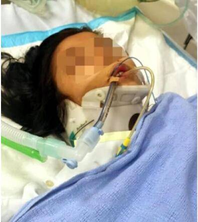 新加坡全岛关注的车祸八岁女童昏迷11天,终于醒了