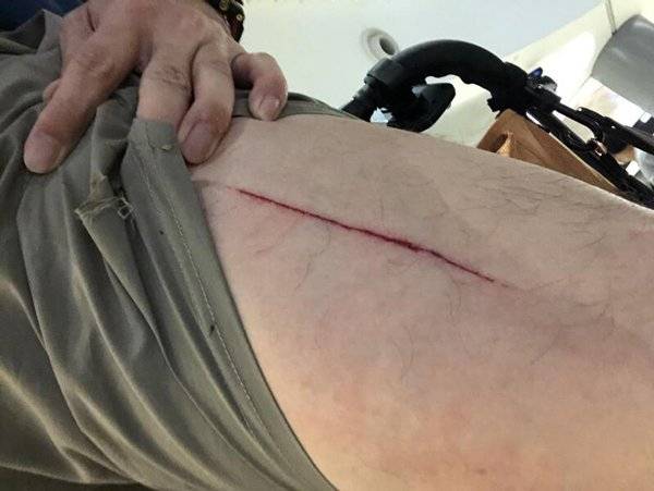 抱16月大女嬰剛坐下 椅子突塌 男子割傷