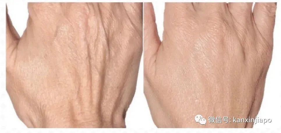 叮咚!@小仙女,己悦医美正在派送你的圣诞礼物...