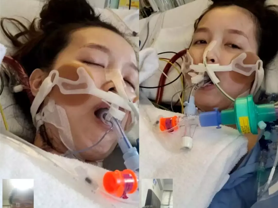 昏迷、吐血!新加坡孕妈两度感染新冠,从鬼门关走一遭后产下宝宝