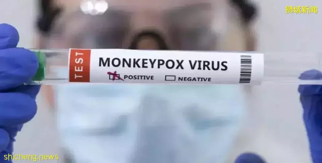 新加坡发现首起本土猴痘病例，源头成谜！患者实拍自述感受！这次会学中国吗