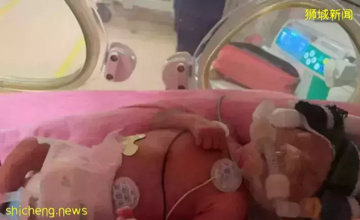 新加坡华人妈妈全网求助，宝宝得怪病、体重一公斤、皮肤近透明