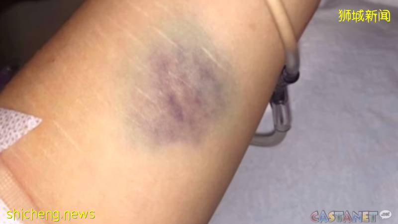 愤怒!华人女生在国外被警察踩头、扯头发和拖拽!亚裔也被歧视