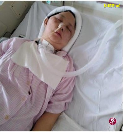 騎腳踏車被撞飛 腦損 夫不離不棄厮守昏迷妻