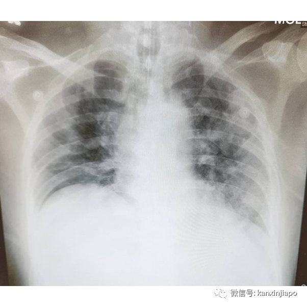 “病人抓我的手说，太痛苦了不要再救我了”