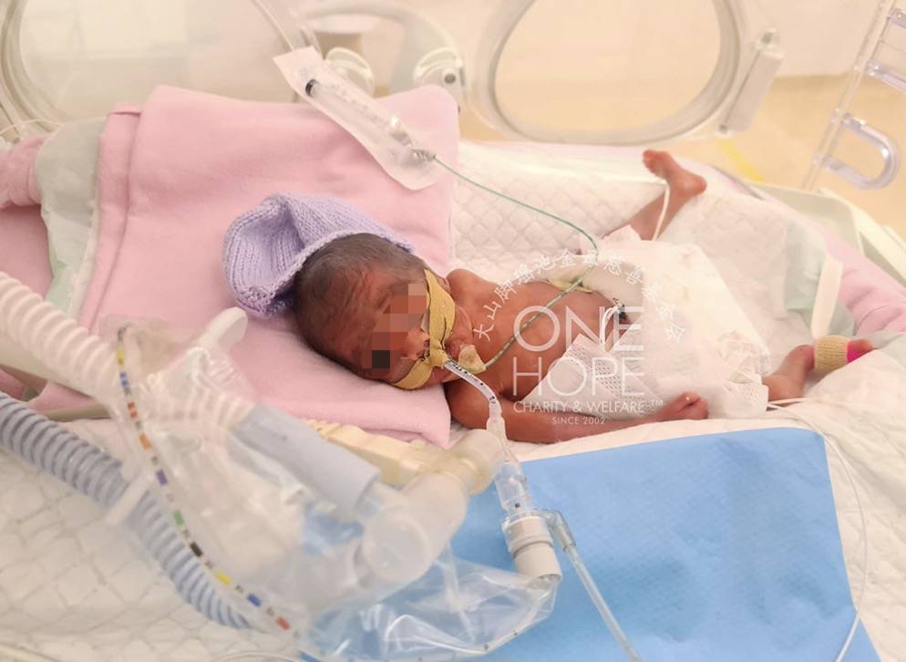 新加坡看病太贵:她的早产儿账单40万新币!女佣病危雇主要花15万新币