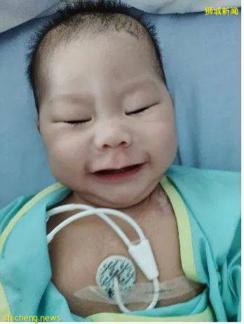 淚目！眼癌、腭裂、呼吸困難……我的寶寶在新加坡剛出生，就開始迎接挑戰