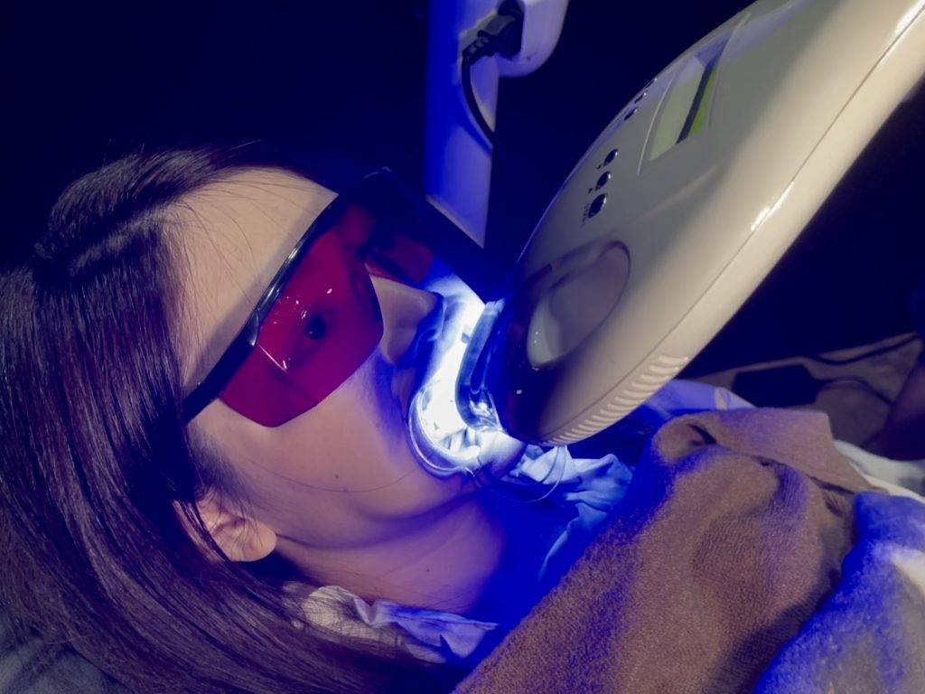 新加坡首家日式幹發按摩💆店，只要S$38新！還有神奇牙齒美白🦷，半小時就可以白4個度