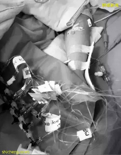 患上多系统炎症综合征 4岁“小斗士”凭毅力征服病魔 