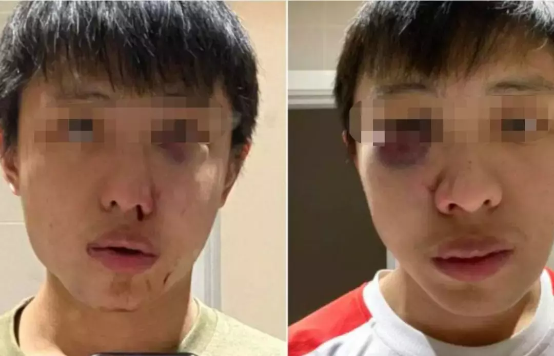 “滾出中國！” 她在深圳地鐵和老外互罵！以前華人被歧視，現輪到老外被怼