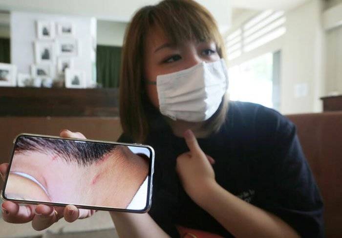 少妇轰老师虐待 像捉兔 伤我儿