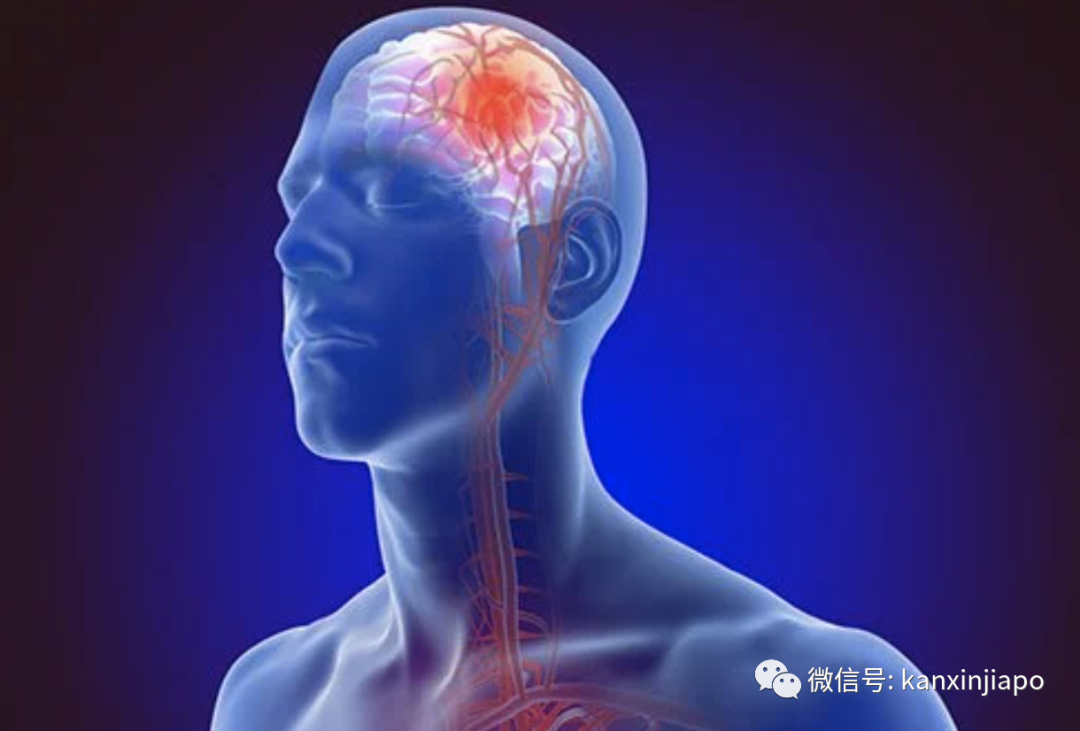 《柳叶刀》：新冠病毒可损害大脑，引起中风、脑膜炎、精神病