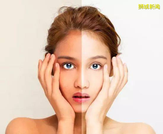 新加坡骨痛熱嚴重！這些防蚊防曬品必備，4折起