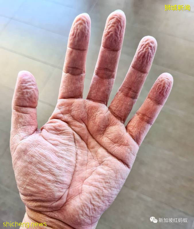 【圖集】獅城與冠病奮戰的前線景象，顛覆你我的想像!