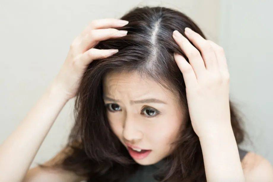 獅城這些“禿”如其來的煩惱,讓它幫你解決