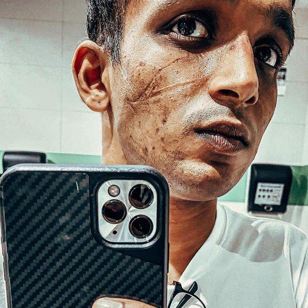 ◤武汉肺炎◢ 前线医疗人员 取消婚礼抗役