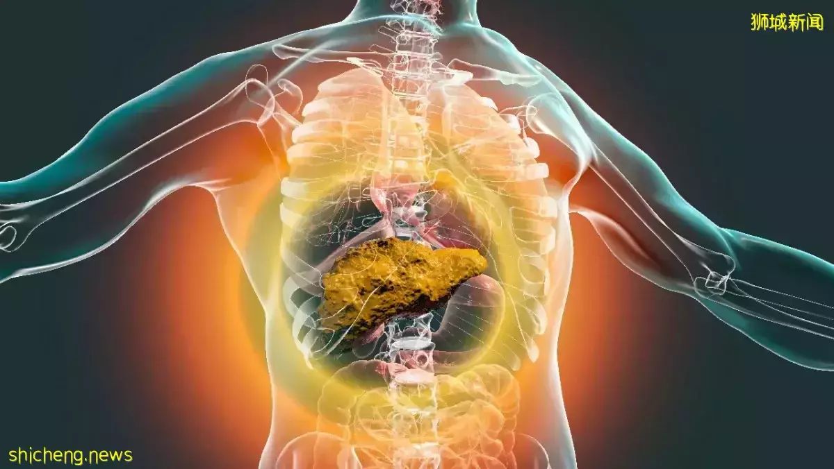 本地临床科研团队获颁经费 研究改善肝细胞癌患者临床治疗