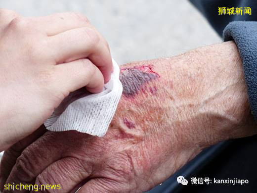 93岁老翁暴打85岁室友,只因睡觉时该不该关灯