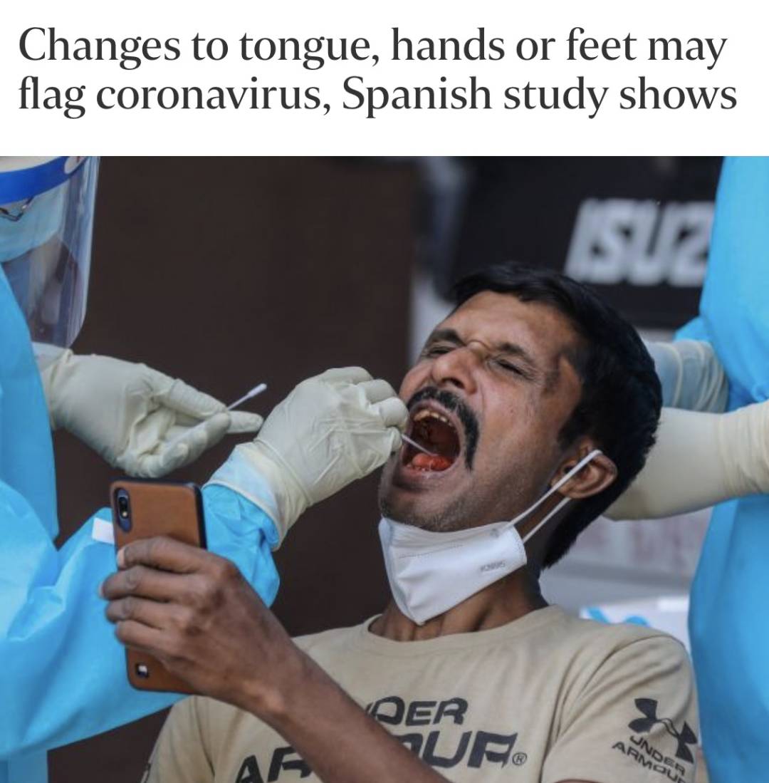 新加坡机场员工紧急检测!曝感染新冠后可能会出现这14种症状