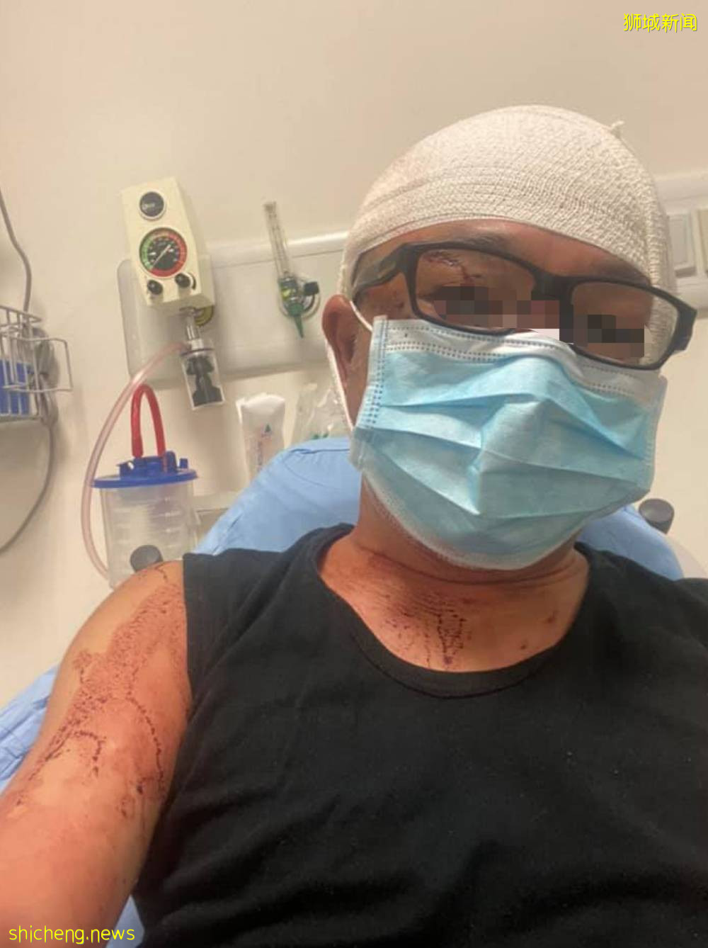 宏茂橋驚現鄰裏傷人案！一男子擦窗時被鄰居用鐵鏈爆頭